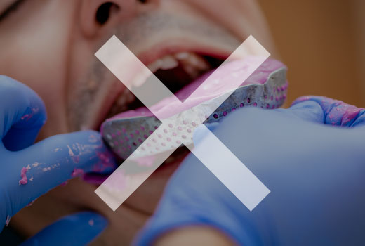 立体撮影/高精細画像/tン時間撮影低被曝